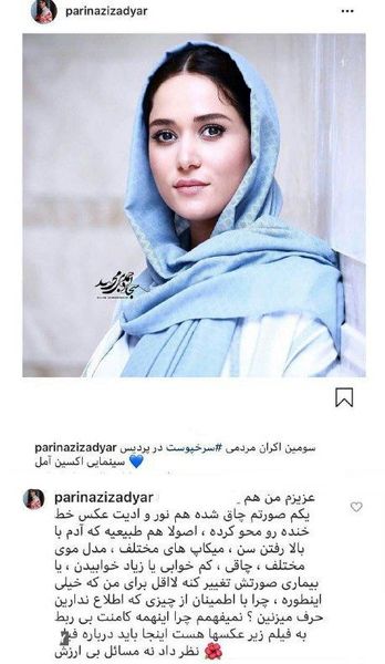 پریناز ایزدیار شاکی شد؛ به چهره من چه کار دارید